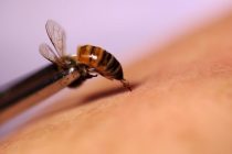 Arı Zehri Ve Kanser