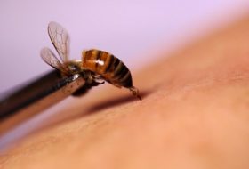 Arı Zehri Ve Kanser